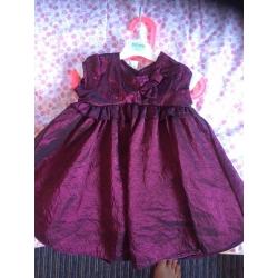 6-9and 9-12 month party dresses